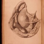 1792 John Hunter Observations on Certain Parts Animal Oeconomy Medicine Surgery
