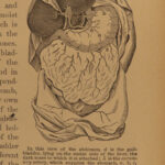 1882 Medicine & Home Surgery American Cyclopedia Domestic Homeopathy Anatomy 3v