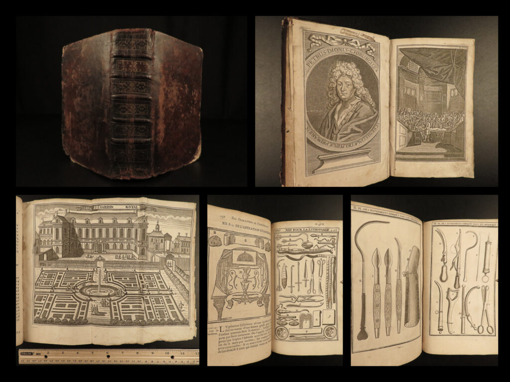 1751 surgery medicine illustrated operations french illustrated chirurgie dionis | pierre dionis was a 17<sup>th</sup>-century french surgeon who wrote several medical dissertations concerning human anatomy and surgical procedures. He taught operative surgery at the jardin-du-roi, paris, a famous training ground for surgeons. (g&m). ‘<em>course of surgical operations</em>’ is an important and thorough collection of surgery demonstrations <strong>with 64 engravings </strong>depicting surgical tools and how to use them.