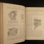 1887 Henry Gray GRAY’S ANATOMY Human Surgery Illustrated Medicine Physician