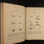 1887 Henry Gray GRAY’S ANATOMY Human Surgery Illustrated Medicine Physician