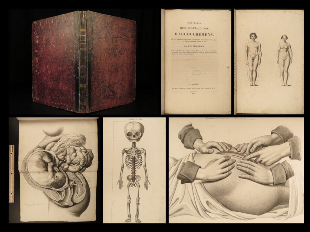 1822 anatomy plates 1ed childbirth demonstrations maygrier medicine pregnancy | jacques-pierre maygrier’s ‘<em>childbirth demonstrations’</em> is a rare 19<sup>th</sup>-century medical treatise focusing on all aspects of pregnancy, midwifery, and childbirth. While numerous works on childbirth exist from this era, this particular work is of the utmost desirability – it contains <strong><u>incredible full-page and double-page engravings</u></strong> each depicting male and female anatomy, various stages of pregnancy, and infant deformities and maladies.  