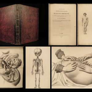 1822 Anatomy PLATES 1ed Childbirth Demonstrations Maygrier Medicine Pregnancy