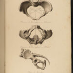 1822 Anatomy PLATES 1ed Childbirth Demonstrations Maygrier Medicine Pregnancy