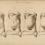 1822 Anatomy PLATES 1ed Childbirth Demonstrations Maygrier Medicine Pregnancy