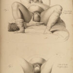 1822 Anatomy PLATES 1ed Childbirth Demonstrations Maygrier Medicine Pregnancy