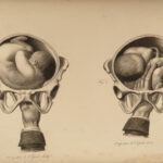 1822 Anatomy PLATES 1ed Childbirth Demonstrations Maygrier Medicine Pregnancy