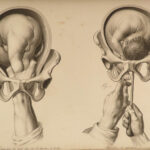 1822 Anatomy PLATES 1ed Childbirth Demonstrations Maygrier Medicine Pregnancy