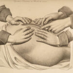 1822 Anatomy PLATES 1ed Childbirth Demonstrations Maygrier Medicine Pregnancy
