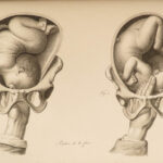 1822 Anatomy PLATES 1ed Childbirth Demonstrations Maygrier Medicine Pregnancy