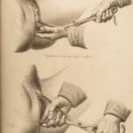 1822 Anatomy PLATES 1ed Childbirth Demonstrations Maygrier Medicine Pregnancy