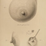 1822 Anatomy PLATES 1ed Childbirth Demonstrations Maygrier Medicine Pregnancy
