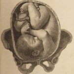 1787 Art of Obstetrics Midwifery Childbirth Illustrated Medicine Baudelocque