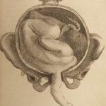 1787 Art of Obstetrics Midwifery Childbirth Illustrated Medicine Baudelocque