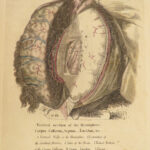 1813 Anatomy of Heart Cranium & Brain Medicine Surgery Cardiology Neurology RARE