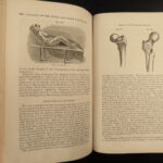 1859 1st edition GROSS Anatomy & Surgery Medicine Pathology Civil War 2v Set