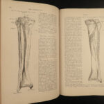 1883 Henry GRAY’S ANATOMY Human Surgery Illustrated Medicine Physician Pick ed