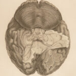 1810 Neurology 1ed Brain Anatomy Spurzheim & Gall Physiognomy Phrenology FOLIO