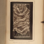 1875 Civil War Medicine & Surgery ATLAS Scurvy Measles Pathology FEVERS Plates