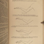 1881 1ed Charcot Lectures Diseases Old Age Geriatric Medicine Pathology Surgery