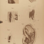 1881 1ed Charcot Lectures Diseases Old Age Geriatric Medicine Pathology Surgery