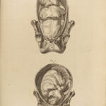 1791 RARE Motherby ANATOMY ATLAS Medical Surgery SMALLPOX Medicine Neurology