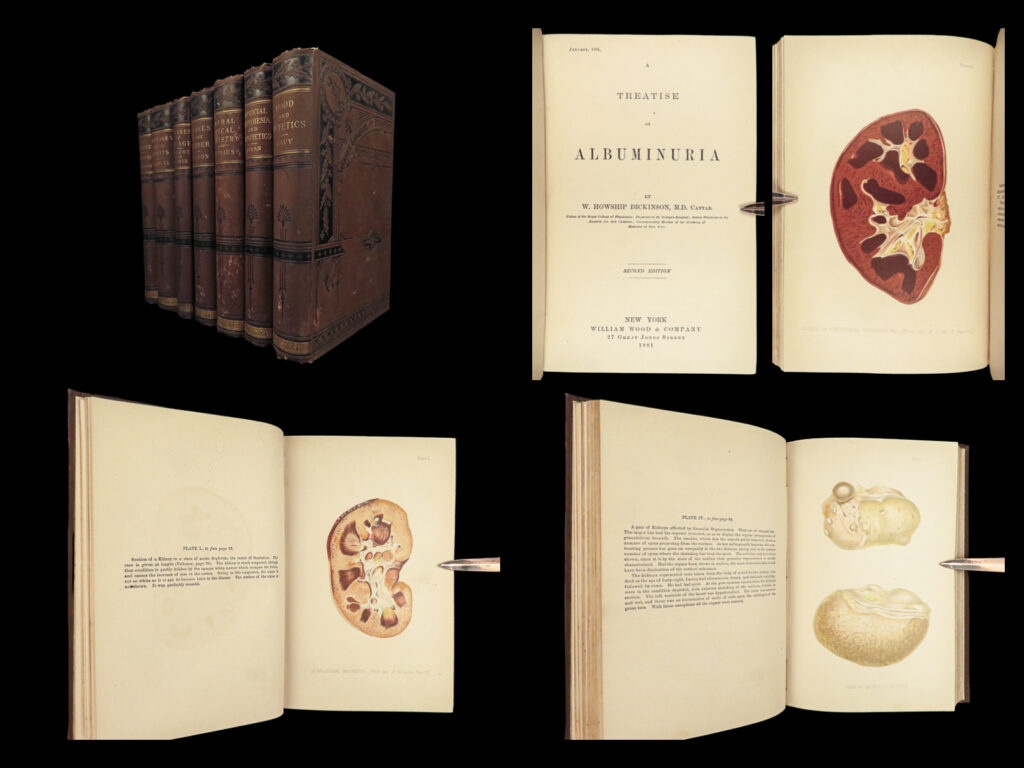 1881 medical book lot medicine diseases surgery charcot diet health anatomy |   a rare collection of medical treatises published by william wood and co in 1881. This lot features lectures on aging, treatises on joint diseases, treating albuminuria, food and dietetics, and even a treatise on anesthesia.