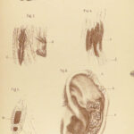 1881 Medical Book Lot Medicine Diseases Surgery Charcot Diet Health Anatomy