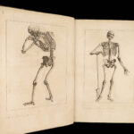 1760 RARE Human ANATOMY Surgery Atlas Roger Piles + Audran Proportions FOLIO 2n1