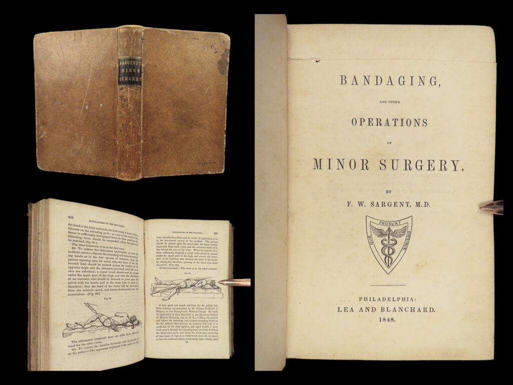 1848 bandaging & surgery 1ed operations pre civil war blood medicine sargent | sargent’s<em> ‘on bandaging and other operations of minor surgery’ </em>is a practical field guide to surgical and medical practices in the civil war. Sargent’s book includes: <ul> <li>instruments</li> <li>surgical dressings and their rules</li> <li>water</li> <li>the douche</li> <li>bandages and their application</li> <li>fractures and setting them</li> <li>dislocations</li> <li>bloodletting</li> <li>phlebotomy</li> <li>arteriotemy</li> <li>counter irritations</li> <li>arresting hemmorage</li> <li>catheters</li> <li>injections</li> <li>pain relief</li> <li>and more! </li> </ul> <em> </em> this rare 1848 1<sup>st</sup> edition includes black and white illustrations throughout.