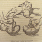 1810 SURGERY John Bell 1ed Principles Pathology Anatomy MEDICINE Bandages Tumors