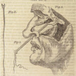 1810 SURGERY John Bell 1ed Principles Pathology Anatomy MEDICINE Bandages Tumors