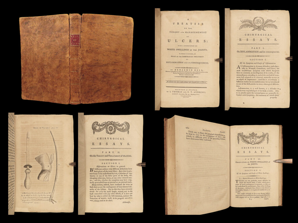 1791 boston usa medicine 1ed benjamin bell ulcers inflammation gangrene sores | benjamin bell was an 18<sup>th</sup>-century scottish surgeon, often considered to be the most important surgeon from scotland. He published ‘<em>system of surgery’</em> – an english handbook designed to teach surgery and various aspects of pain relief. Beyond ‘<em>system’</em>, bell published a treatise on the treatment of ulcers which included his findings on swelling and inflammation.   according to garrison-morton, “bell improved the methods of amputation, introducing the ‘triple incision of bell… [system of surgery] is his best work”.   this 1791 first american edition of bell’s ‘<em>ulcers’</em> was published in boston.