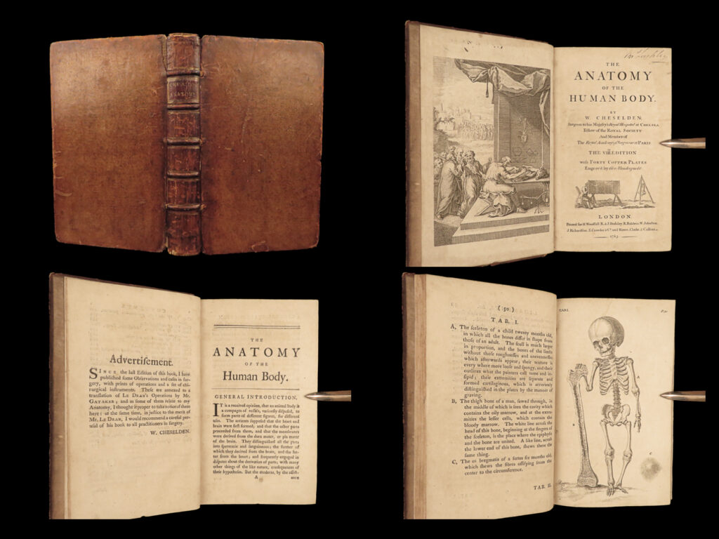 1763 surgery cheselden human anatomy medicine skeleton bones illustrated english | william cheselden was an 18<sup>th</sup>-century english surgeon who is best known for his contributions to the study of human anatomy. He published a collection of anatomical tables that were notable for their impressive illustrations – illustrations that depict the human figures in curious poses. His studies were instrumental in the processes of surgically removing bladder stones.