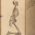 1763 SURGERY Cheselden Human Anatomy Medicine Skeleton Bones Illustrated English