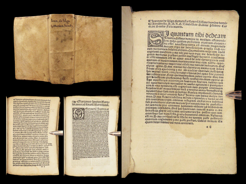 1540 gunshot wound treatment medicine giovanni vigo surgery gunpowder poison |   giovanni da vigo was a 15<sup>th</sup>-century italian physician known for his comprehensive studies in surgery, medicine, and human anatomy. His works were so widely read that they were translated into english in the early 16<sup>th</sup>-century. Not only that, but his “<em>practica</em>” became the standard surgical reference for battlefield surgeons because of his attention to the treatment of gunshot wounds.   prior to vigo, few works were written to describe the treatment of gunshot wounds; and even though vigo’s assessments of gunpowder were incorrect [i. E. Gunpowder was poison], the influence of his study on gunshot wound therapy cannot be understated. Vigo also discussed the treatment of ulcers, syphilis, bone fractures, as well as pseudo-medical techniques like aphrodisiacs, cosmetics, and astrological-phase dietary adjustments.   this 16<sup>th</sup>-century edition of the works of vigo was published in lyon in the 1540s.   item number: #28122 price: $950