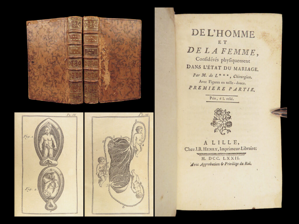 1772 marriage 1ed men vs women female reproduction anatomy impotence lignac 2v |   “<em>on man and woman physically considered</em>” is a rare, 18<sup>th</sup>-century survey on the physical, moral, and philosophical aspects of men and woman as it relates to marriage. Written by french enlightenment scholar louis de lignac, this work examines the anatomical differences between males and females with special attention given to the procreative and reproductive systems. Lignac also discusses the specific gender roles for men and women in a marriage.   other notable topics included in this work include: <ul> <li>human temperaments and its effect on marriage</li> <li>using aphrodisiacs to excite intimacy</li> <li>causes of impotence</li> <li>issues related to sterility</li> <li>on the institution of marriage</li> </ul>   item number: #27890 price: $599