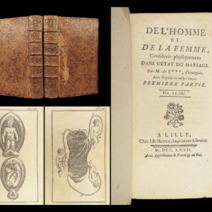 1772 MARRIAGE 1ed Men vs Women Female Reproduction Anatomy Impotence Lignac 2v
