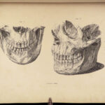 1837 John Hunter Anatomy Atlas Surgery Medicine Illustrated Biology Veterinary