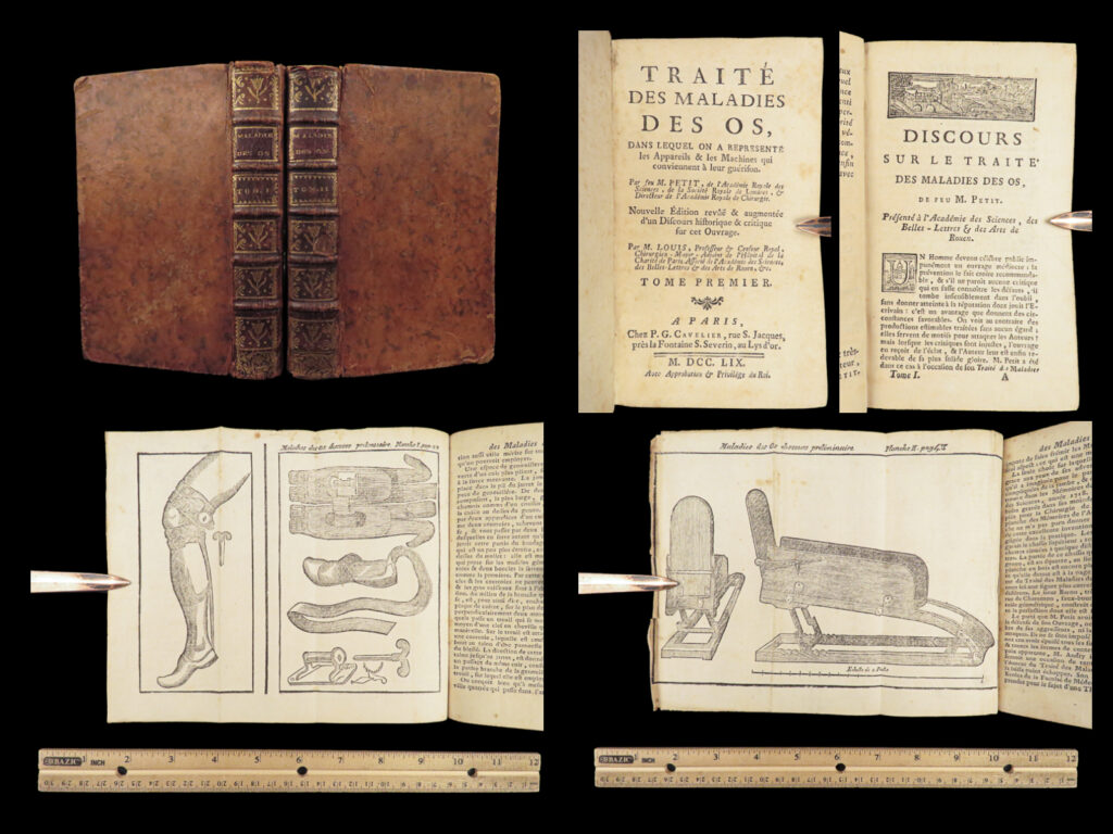 1759 bone diseases surgery petit french medicine malady des os illustrated 2v |   jean-louis petit was one of the most prestigious and important french surgeons, not just of the 18<sup>th</sup>-century, but of the history of french medicine. He was the first director of the academie de chirurgie and often best remembered for his studies in bone diseases. According to garrison morton, petit “invented the screw tourniquet, gave the first account of osteomalacia (bone softening), and was the first to open the mastoid process. ”   item number: #28129 price: $599