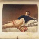 1865 CIVIL WAR Medicine 1st Gunshot Surgery Cholera Fever US War Dept Circulars