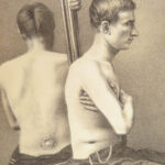 1865 CIVIL WAR Medicine 1st Gunshot Surgery Cholera Fever US War Dept Circulars