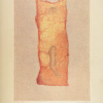 1865 CIVIL WAR Medicine 1st Gunshot Surgery Cholera Fever US War Dept Circulars