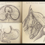 1878 GRAY’S ANATOMY Surgery Illustrated Medicine Physician Cardiology Neurology