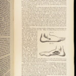 1860 John Erichsen Art of Surgery | USA Hospital Dept issue | Civil War Medicine