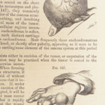1860 John Erichsen Art of Surgery | USA Hospital Dept issue | Civil War Medicine
