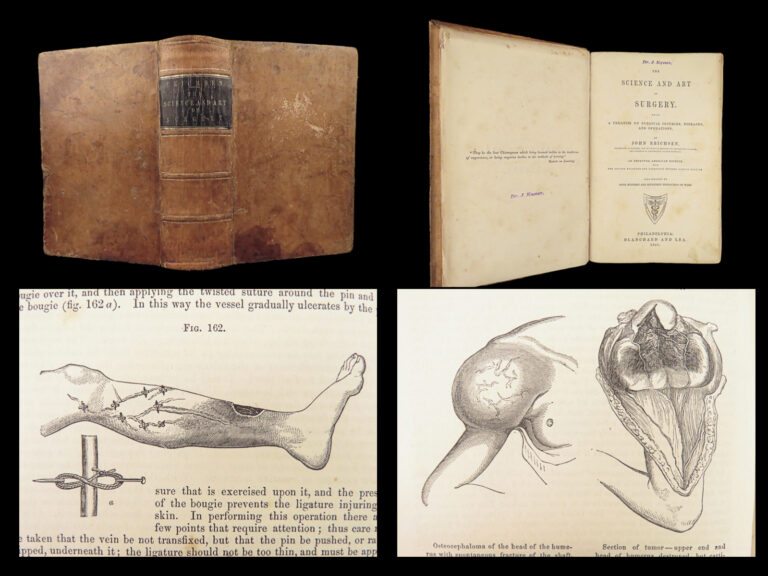 Image of 1860 John Erichsen Art of Surgery | USA Hospital Dept issue | Civil War Medicine