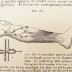 1860 John Erichsen Art of Surgery | USA Hospital Dept issue | Civil War Medicine