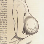 1860 John Erichsen Art of Surgery | USA Hospital Dept issue | Civil War Medicine