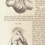 1860 John Erichsen Art of Surgery | USA Hospital Dept issue | Civil War Medicine
